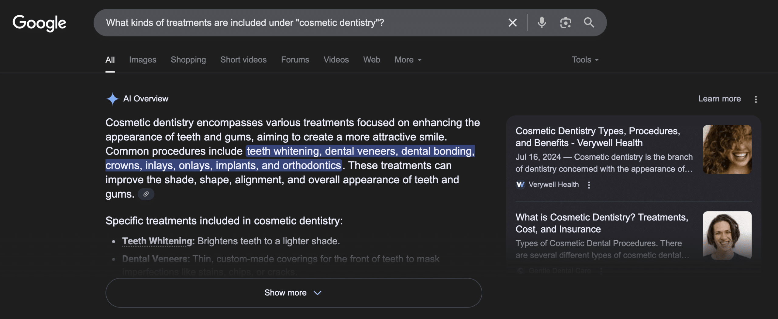 Google search result explaining cosmetic dentistry, listing treatments like whitening, veneers, bonding, crowns, implants, and orthodontics.